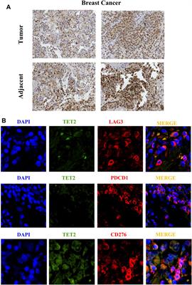 Clinical Significance of TET2 in Female Cancers